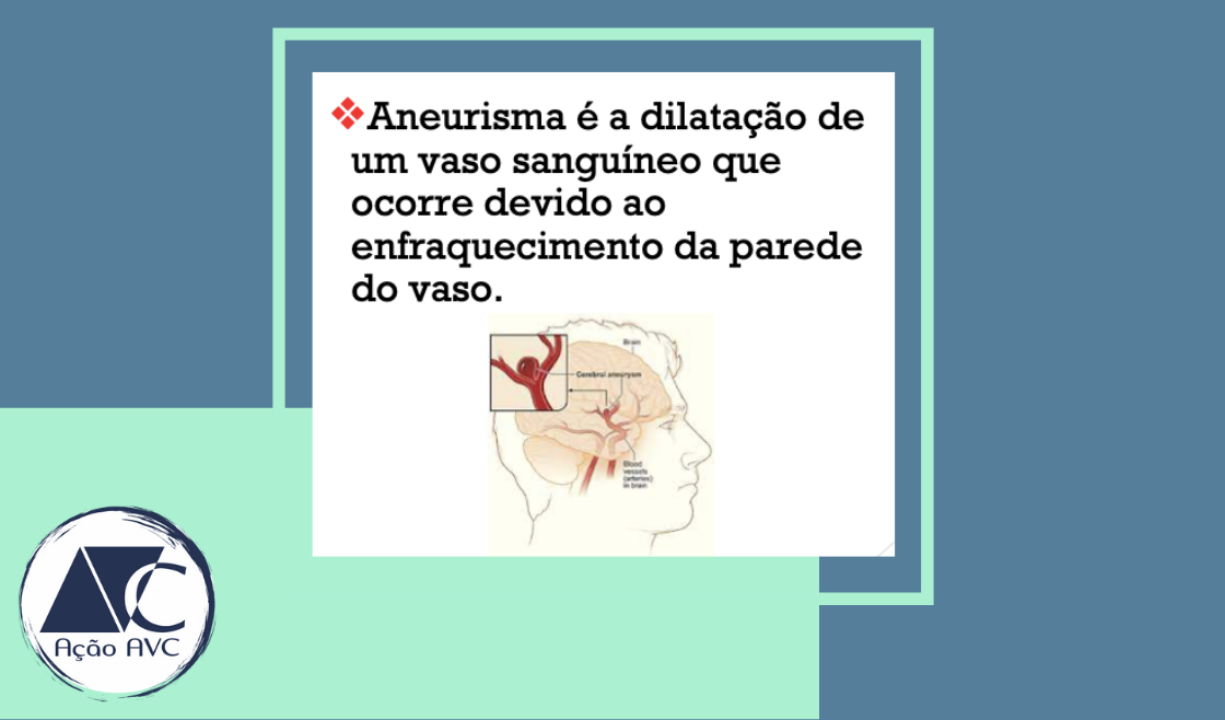 Aneurisma Cerebral Acao Avc