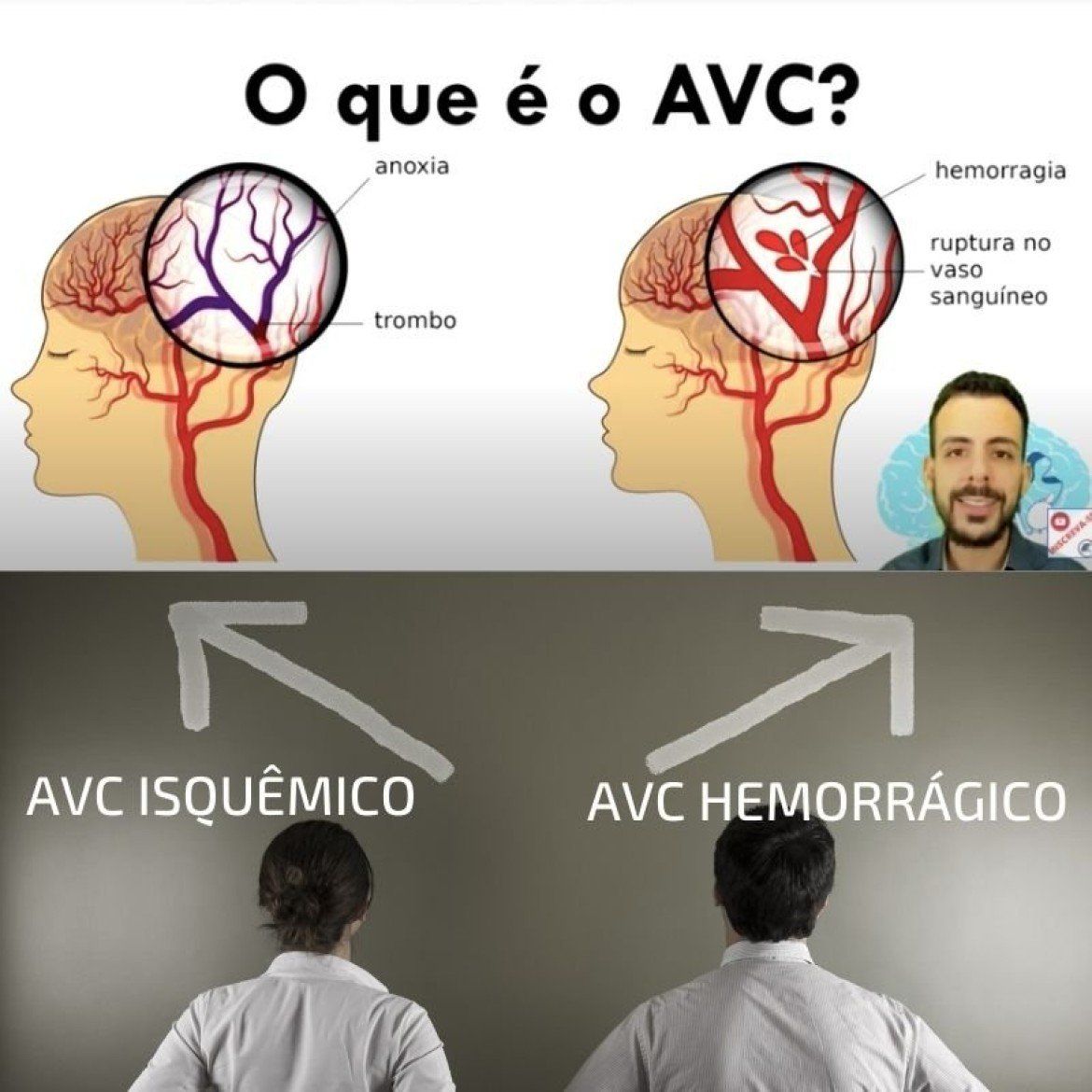 AVC isquêmico e AVC Hemorrágico