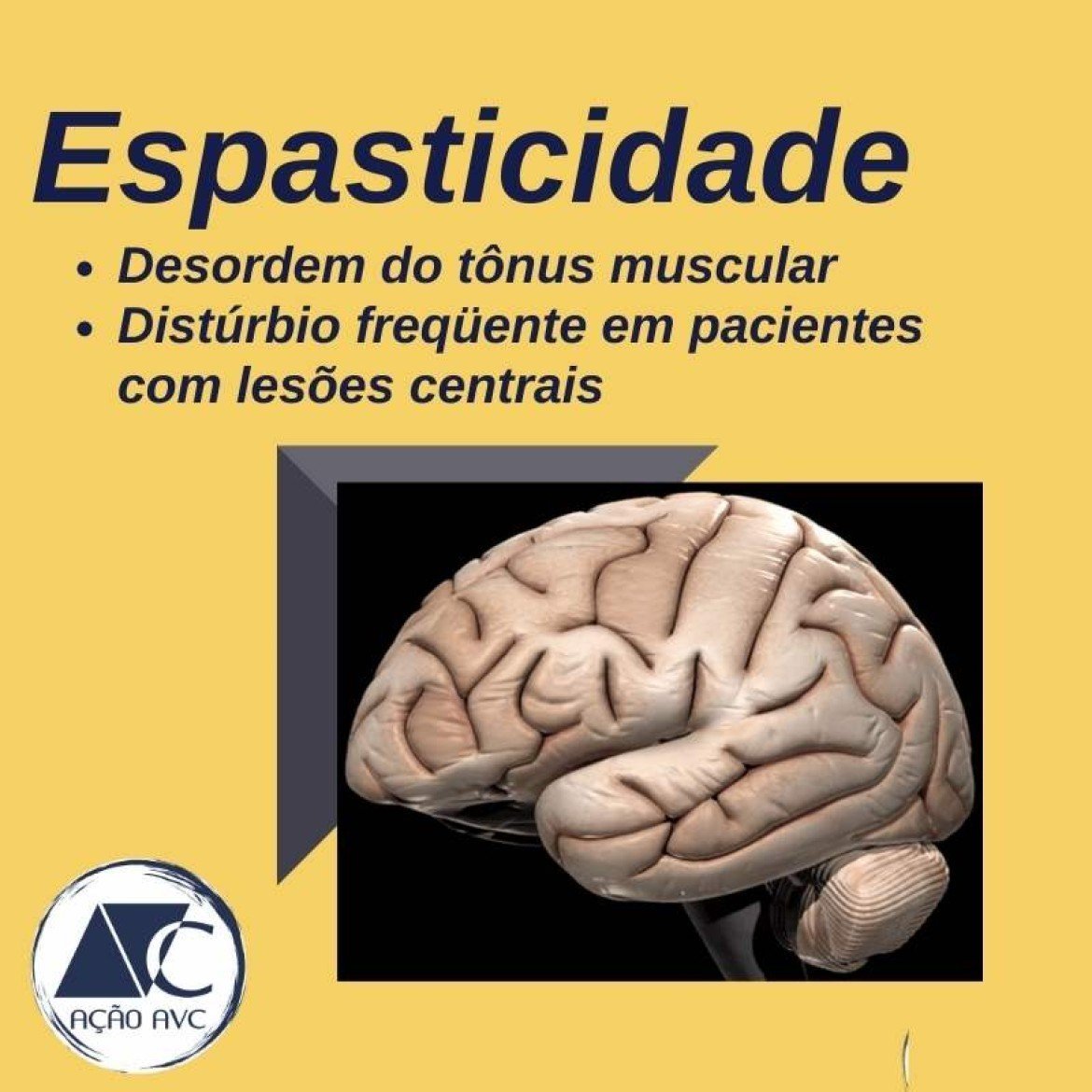 Espasticidade