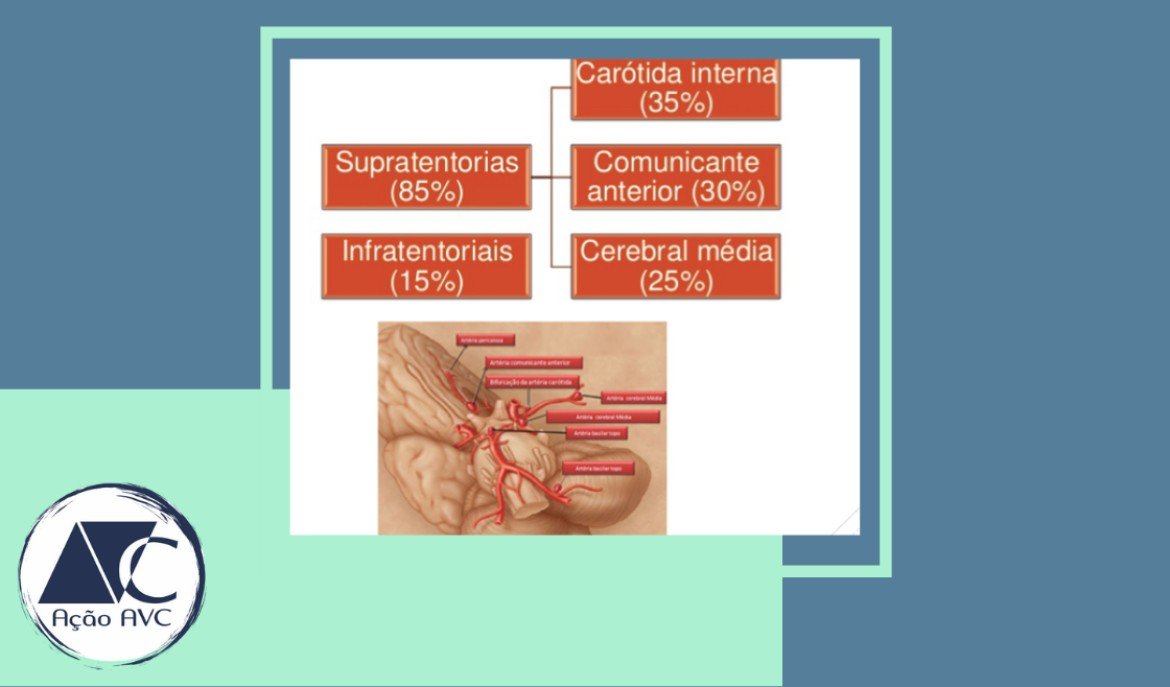 Onde se localiza o aneurisma cerebral