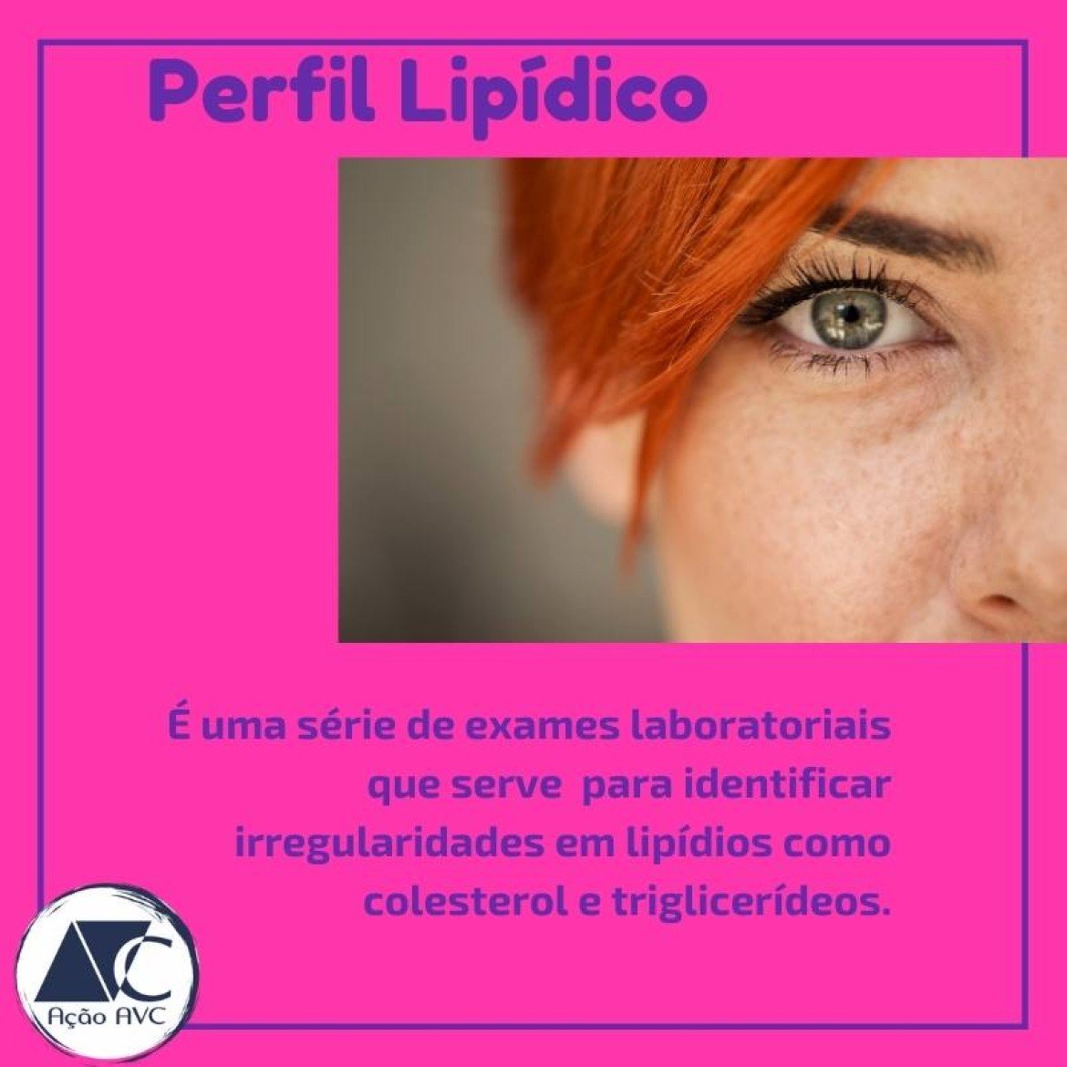 perfil lipídico alterado é um dos fatores de risco para AVC Perfil lipídico é um dos fatores de risco para AVC