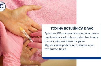 TOXINA BOTULÍNICA NO TRATAMENTO DO AVC