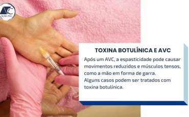 TOXINA BOTULÍNICA NO TRATAMENTO DO AVC